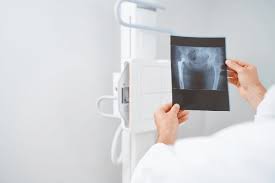 Tryout Online Simulasi Radiografer: Persiapan Optimal Menghadapi Ujian